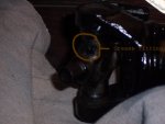 U_joint_replacement_002a.jpg
